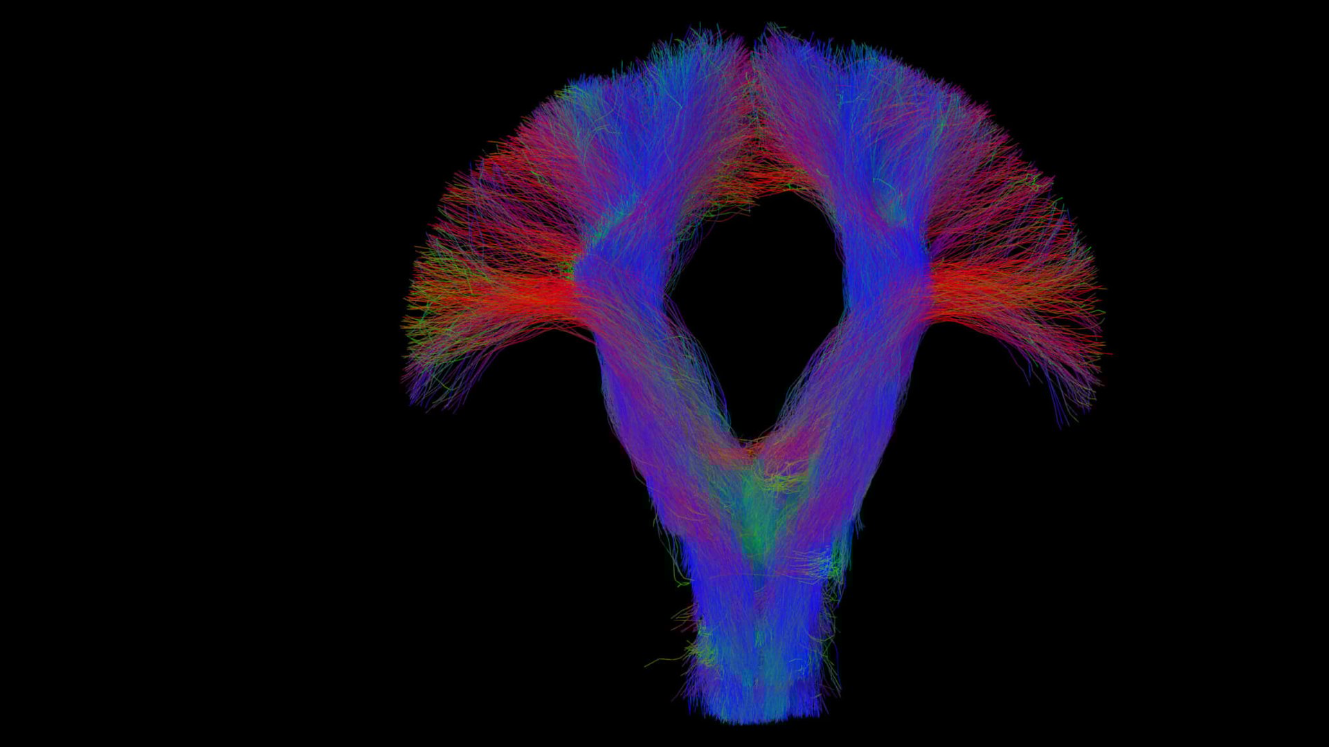 Color-coded 3D visualization of neural pathways
