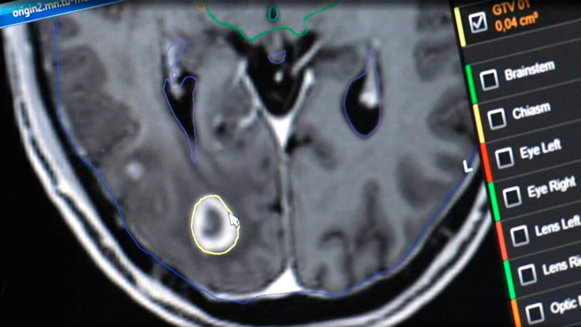 zdf_brainlab_software_screenshot.jpg