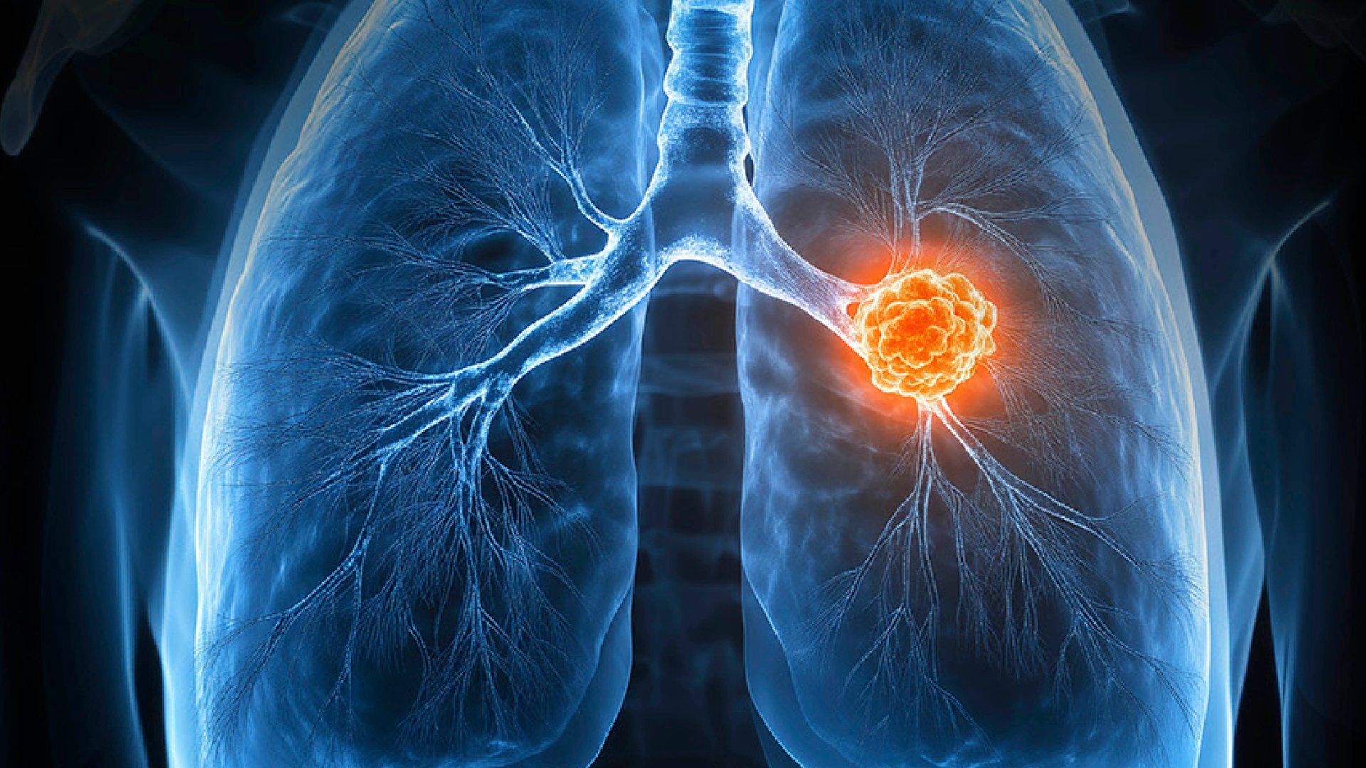 lung_cancer_3840x2160.jpg