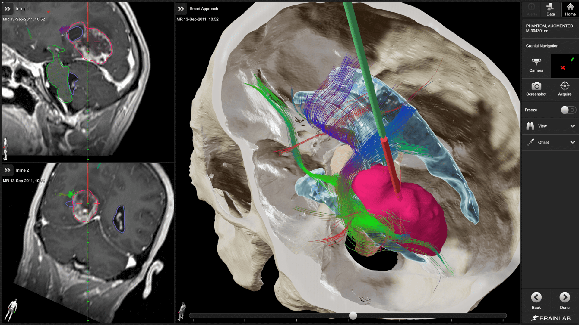 Screenshot: Cranial Navigation Application