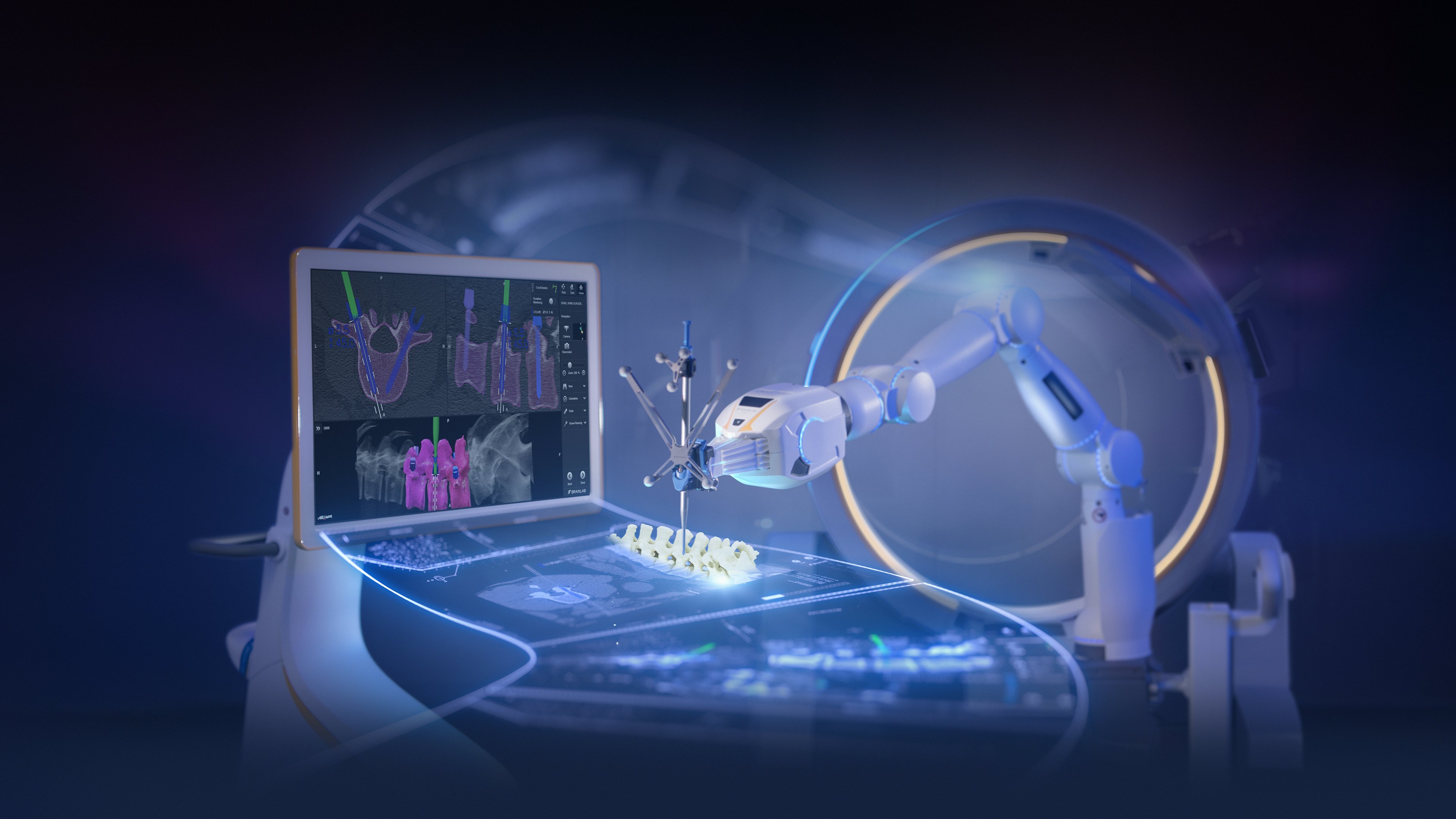 Visual of the Brainlab Robotic Suite in action, highlighting advanced robotic technology for surgical procedures