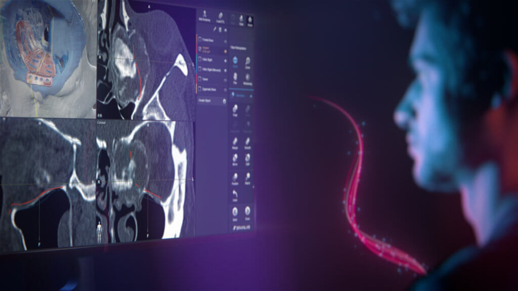 Header Visual: Brainlab Craniomaxillofacial Surgery Planning Software