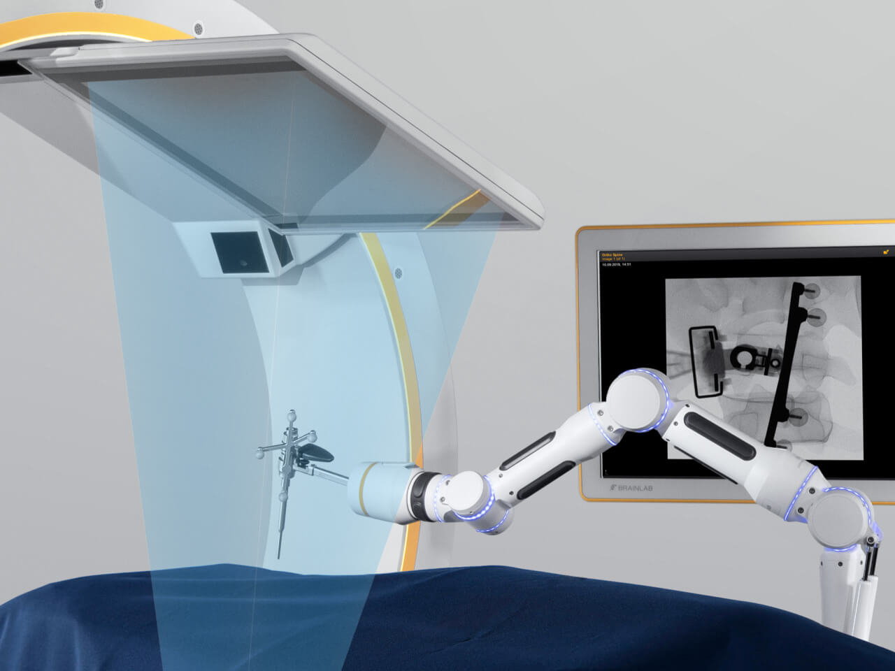 Loop-X mobile imaging robot performing screw placement verification.