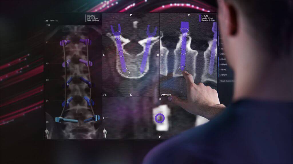 Header Image - Spine Planning with Elements Software