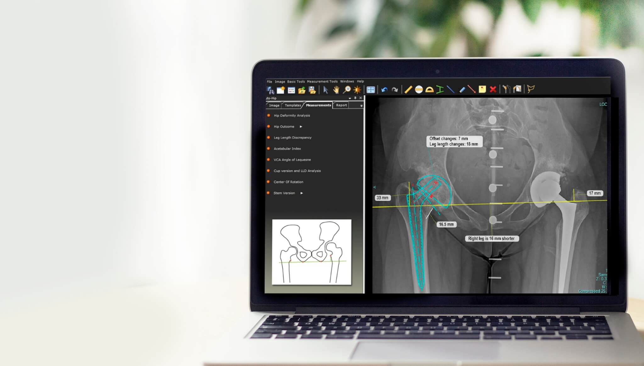 thumbnail_uniuehipanatomy-journal.jpg