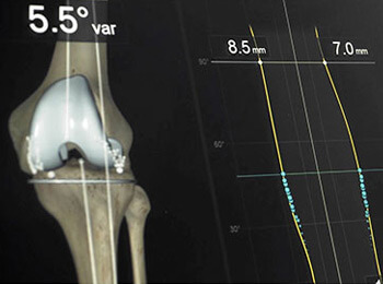 knee-3-news.jpg