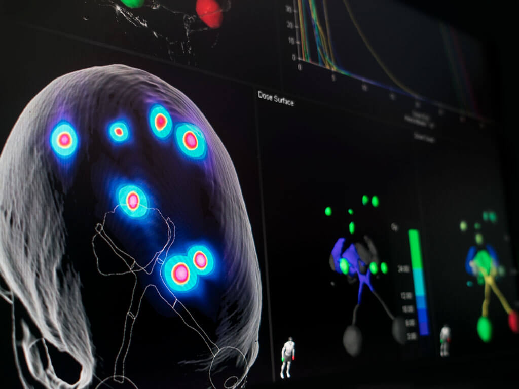multiplebrainmets_2_press_releases.jpg