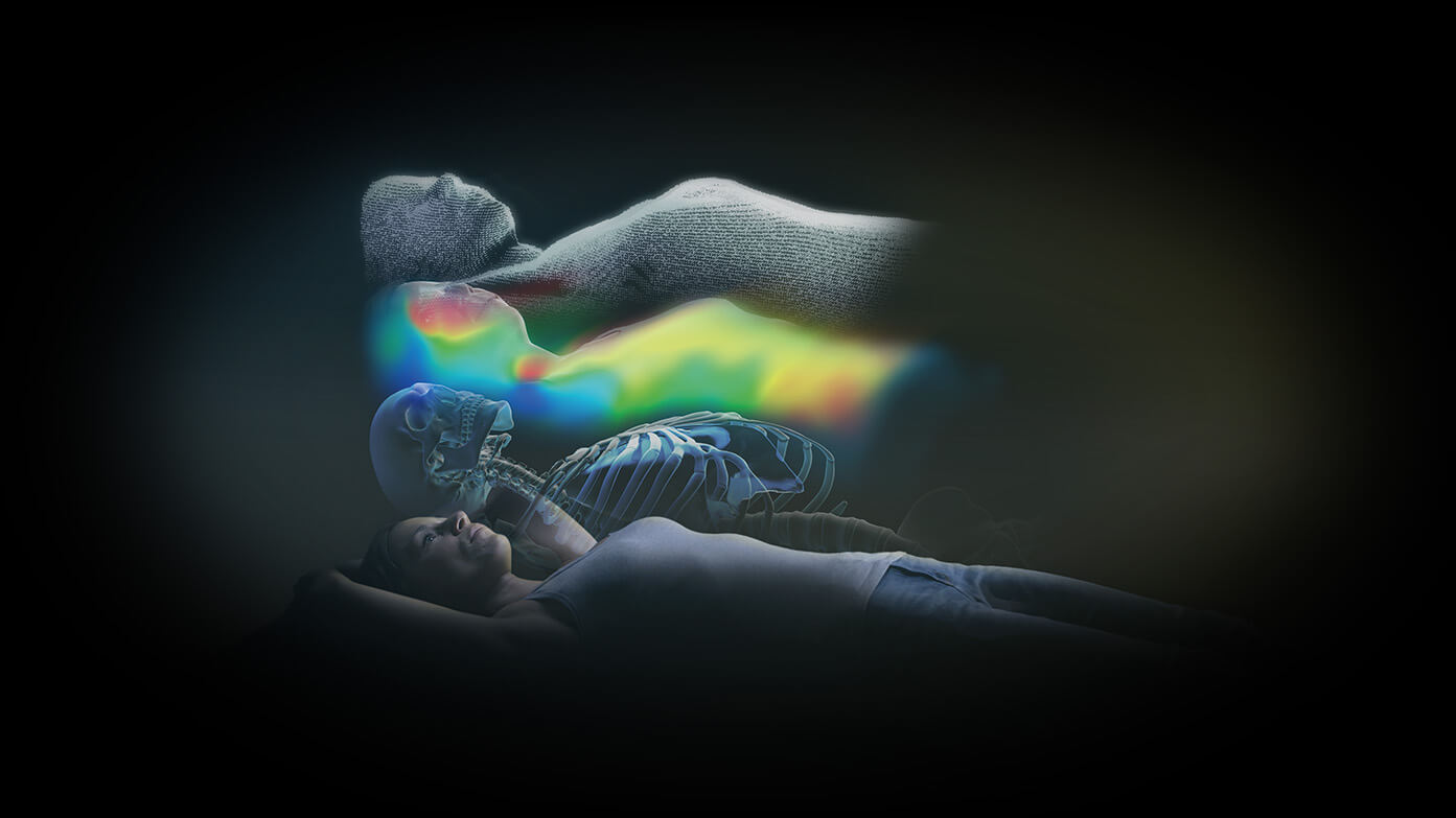 3D imaging of precision patient monitoring during spinal radiosurgery with ExacTrac Dynamic.