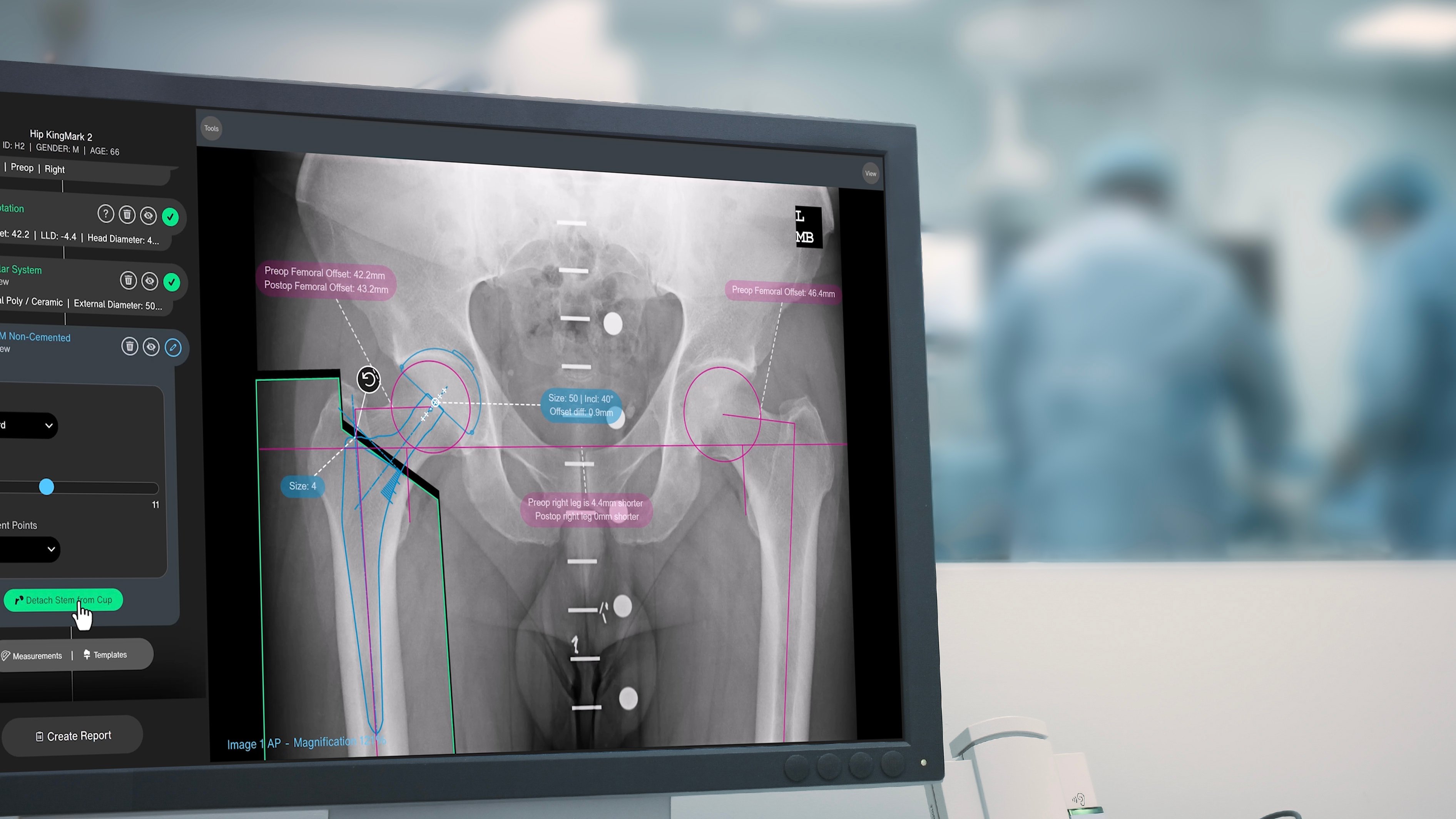 240404_02_traumacad_neo-hip.jpg