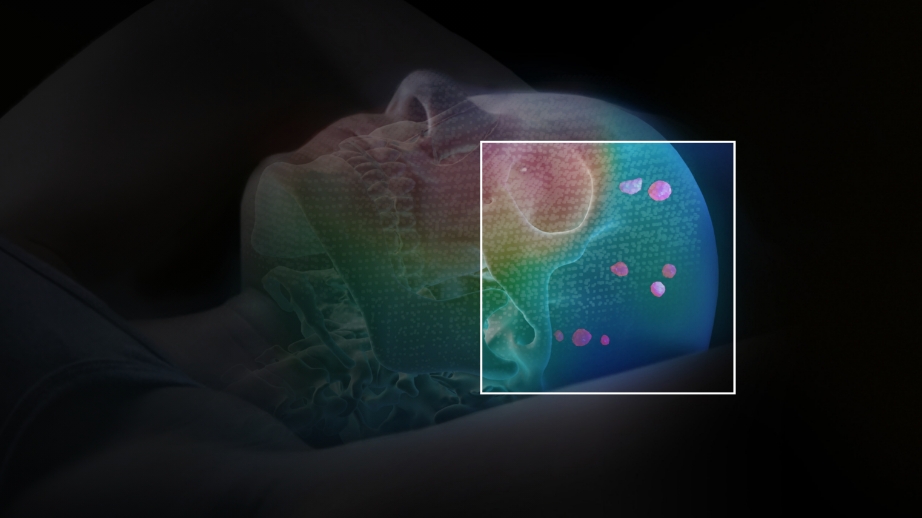 Radiosurgery Platforms & Services | Brainlab