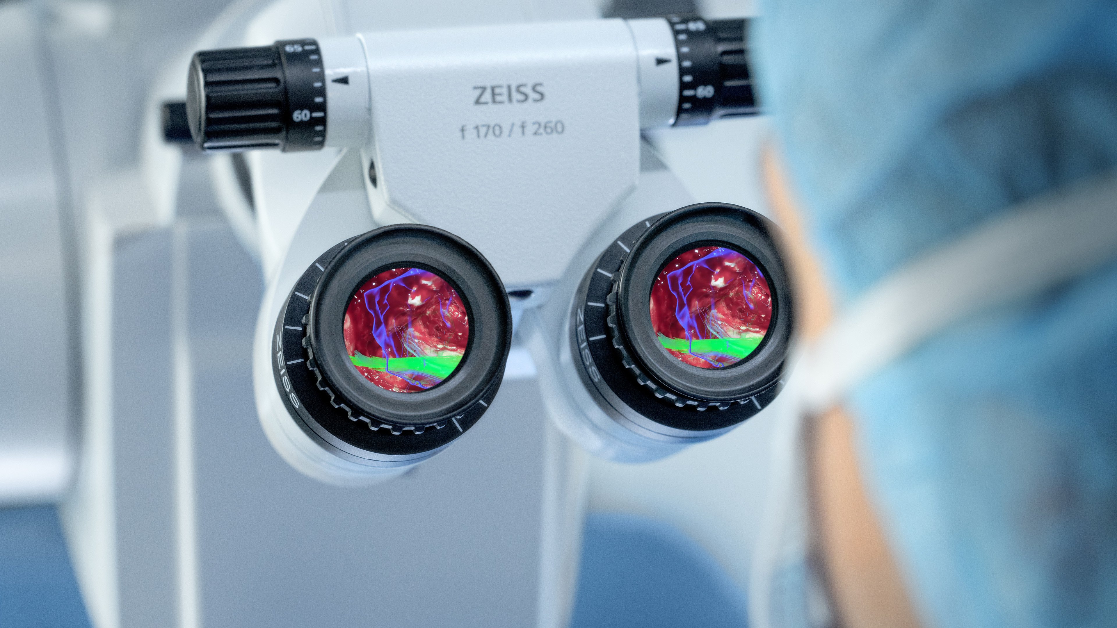 250915_microscopenavigation_cranial_benefit1_enhanceview.jpg