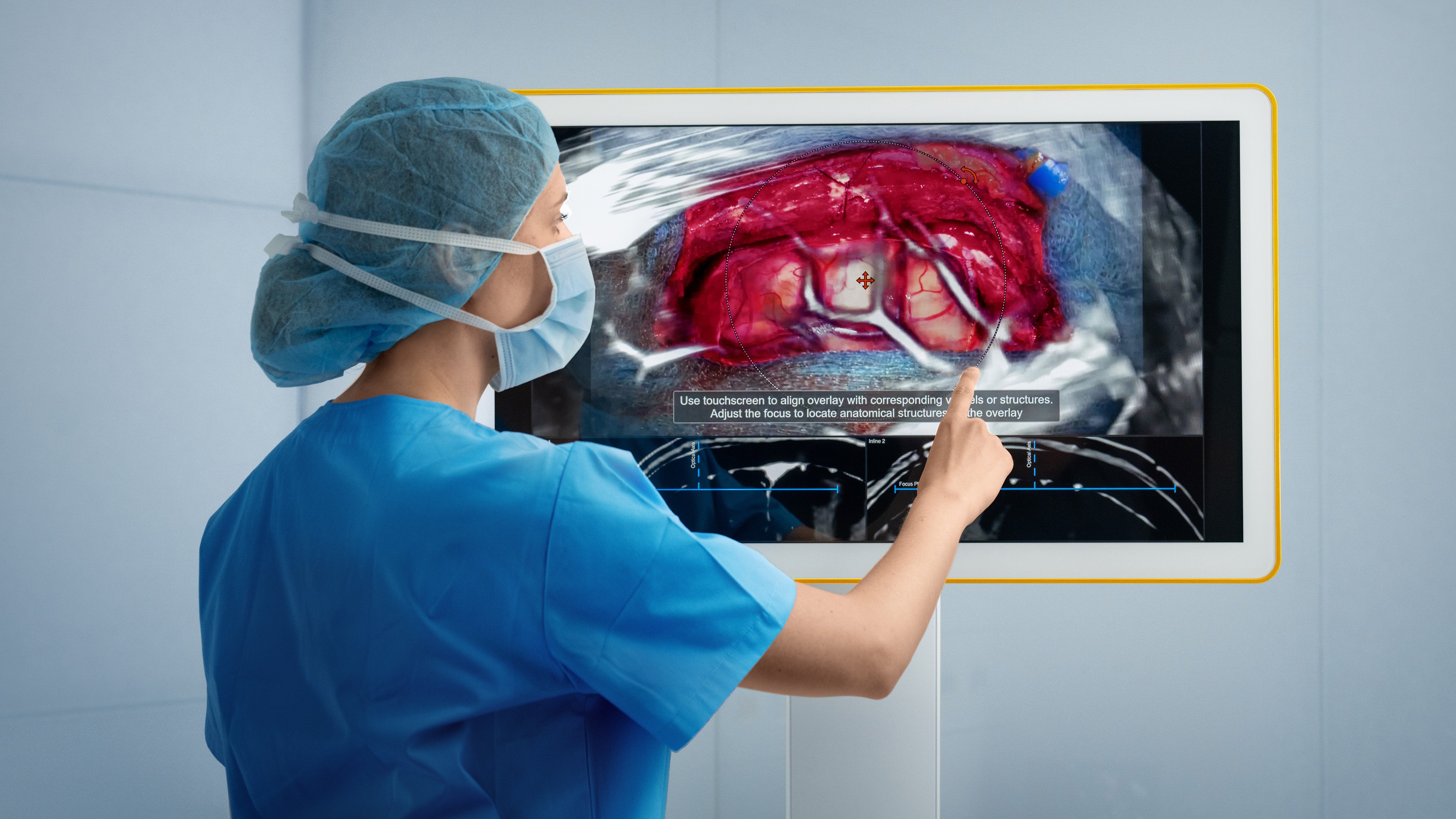 250915_microscopenavigation_cranial_benefit3_realignconfidence.jpg