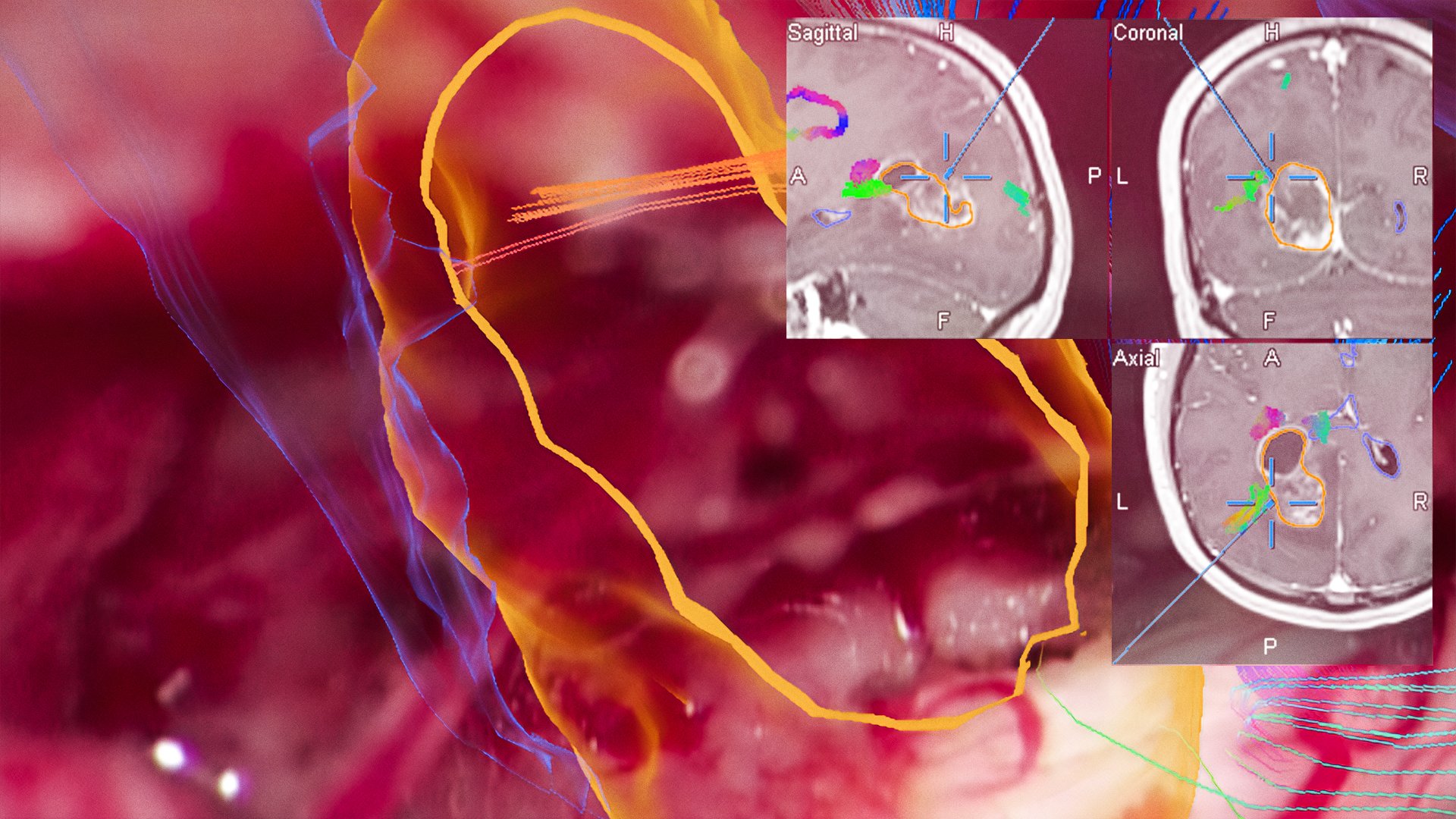 micr_nav_cranial_uniterruptedviewing_sr.jpg