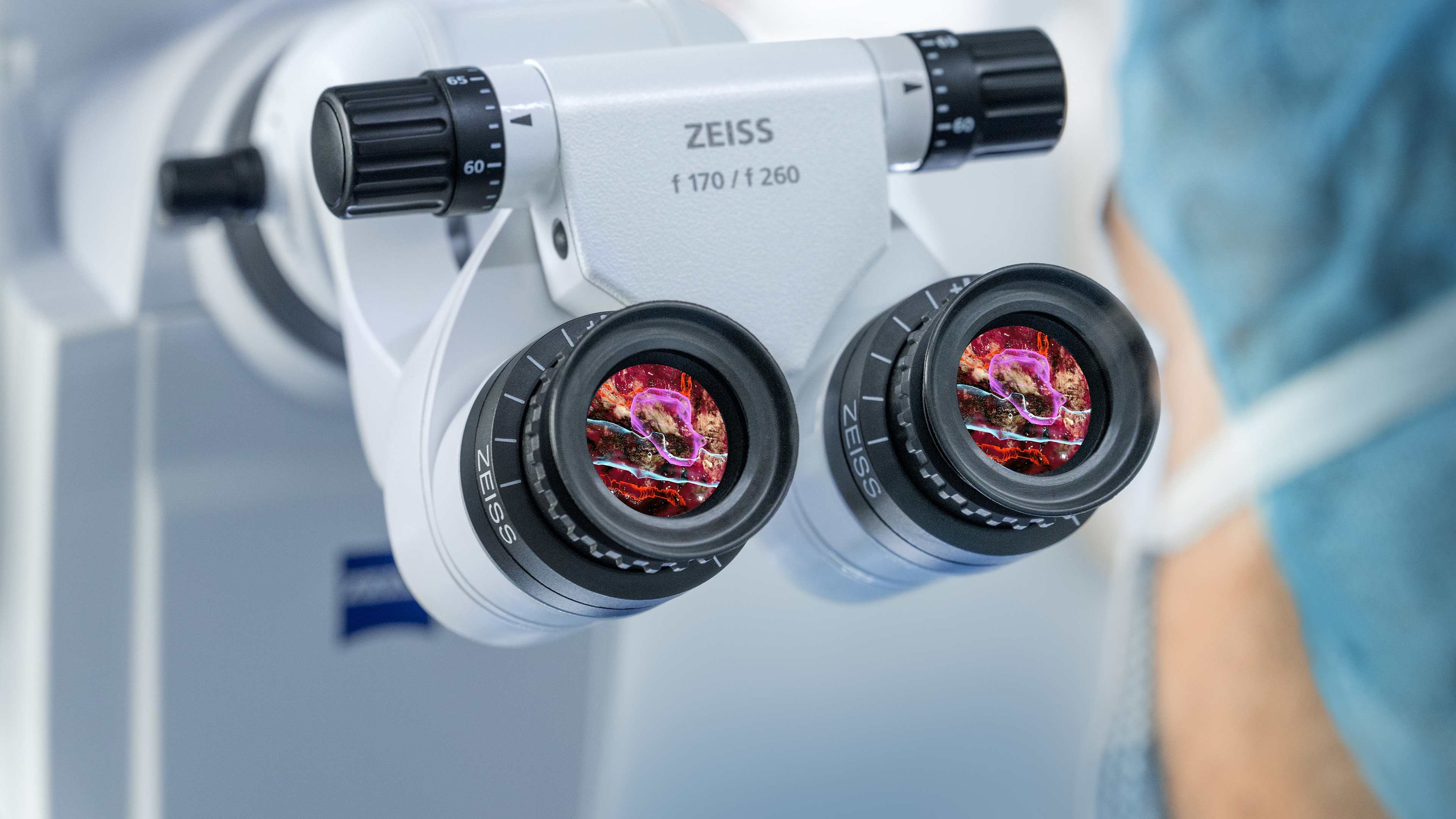 250915_microscopenavigation_spine_benefit2_visualizebeyond.jpg