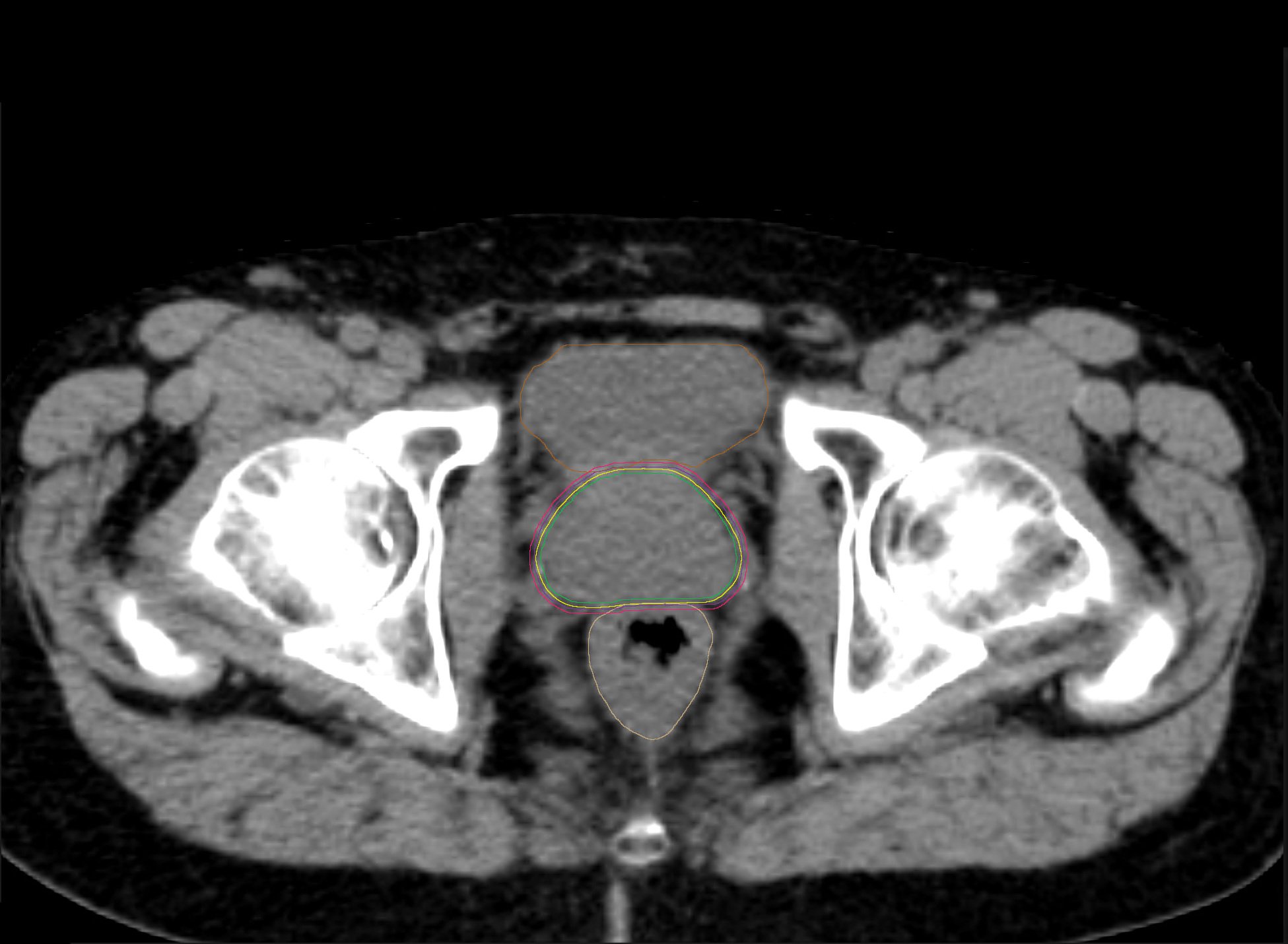 241009_prostate_benefit_03_mca.jpg
