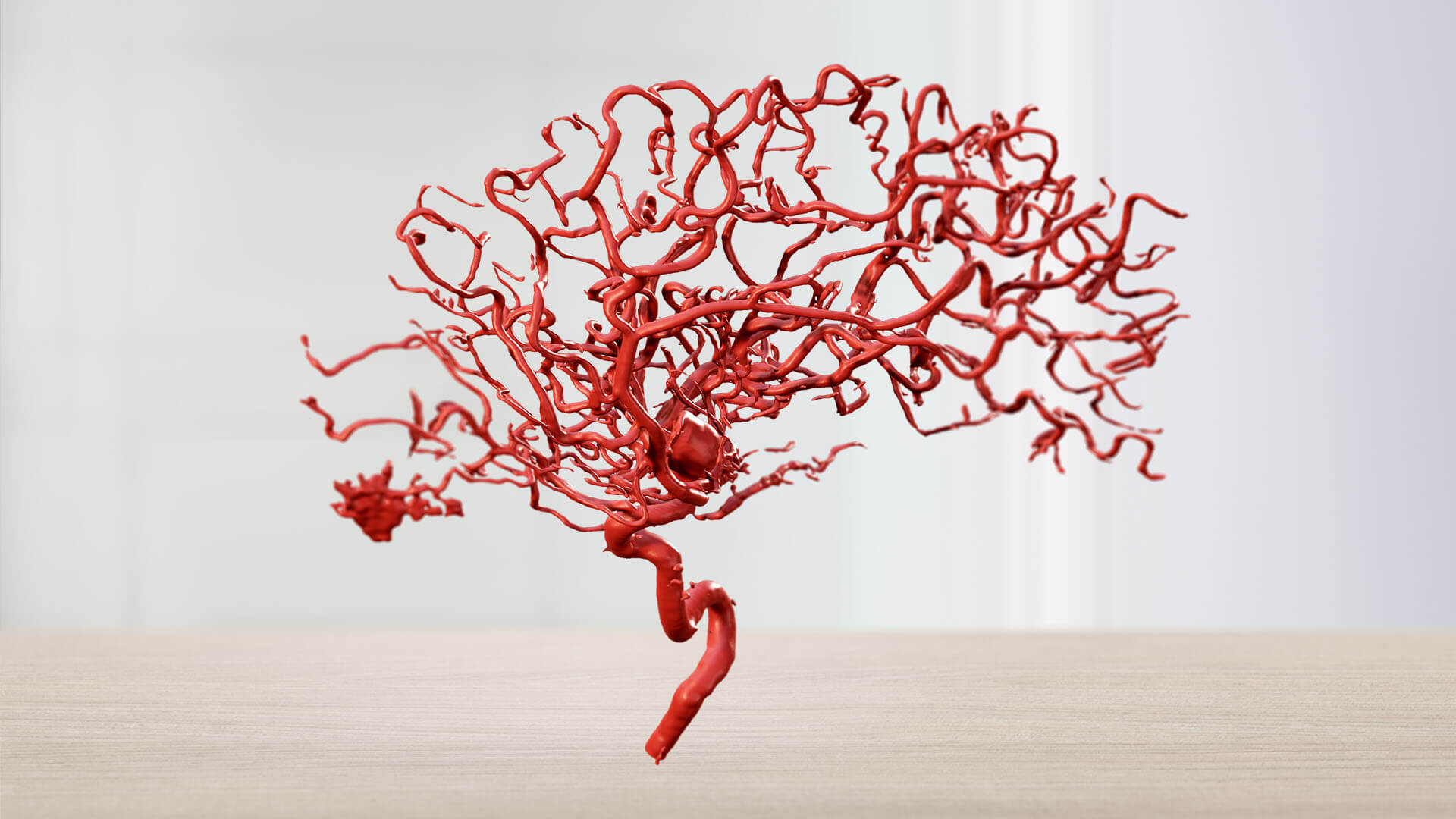 Showcasing the Mixed Reality Viewer for Vascular Indications