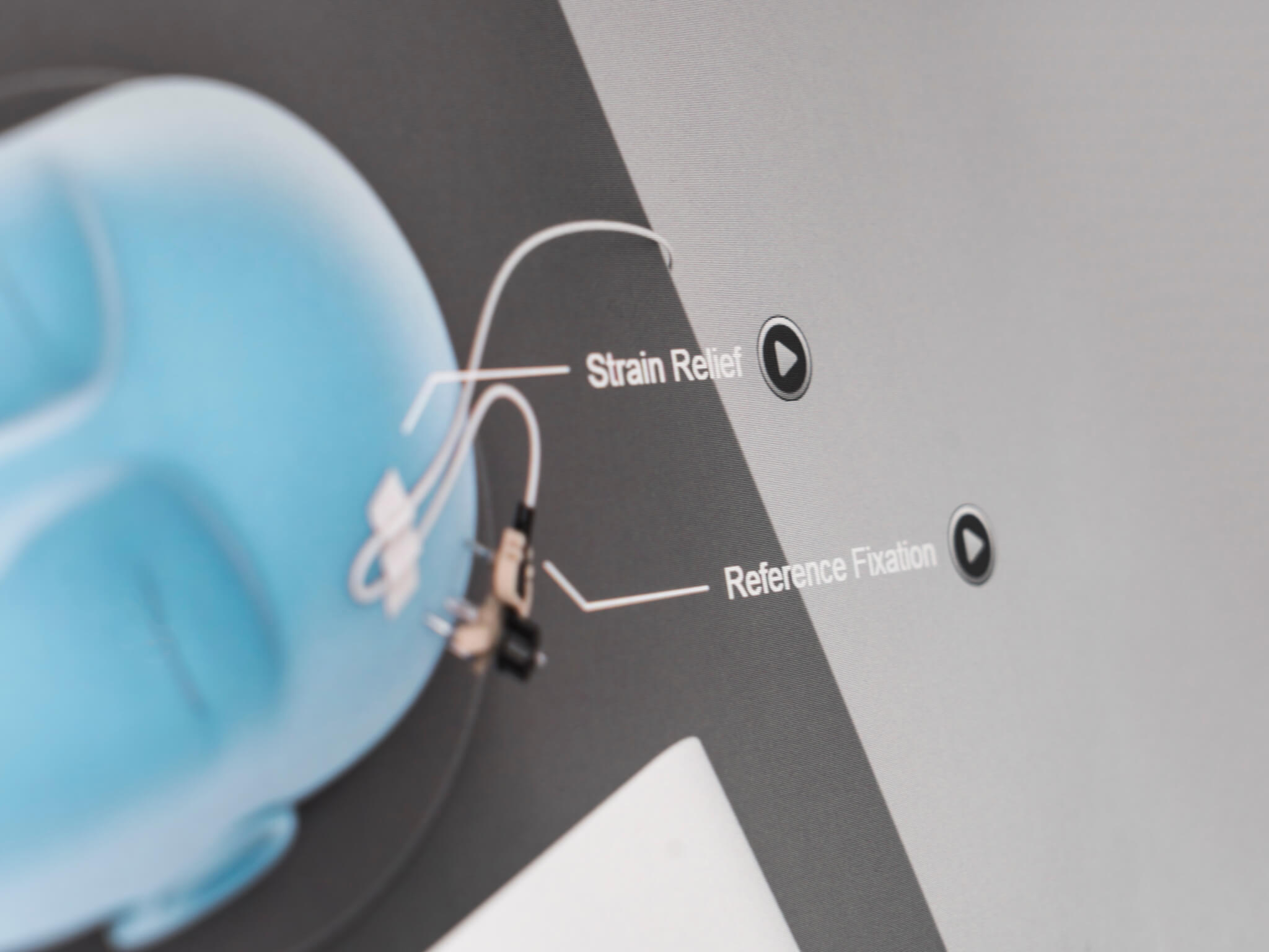 Screenshot: step-by-step workflow guidance with the Brainlab electromagnetic (EM) navigation system