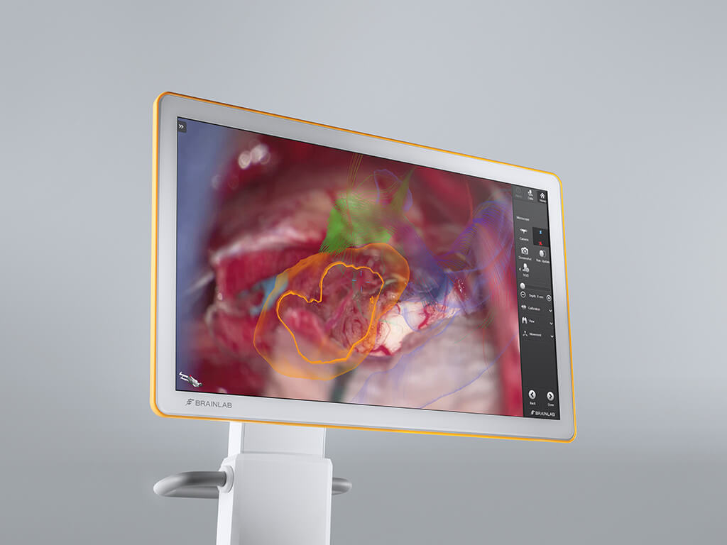 Display of Curve Navigation featuring a detailed endoscope image