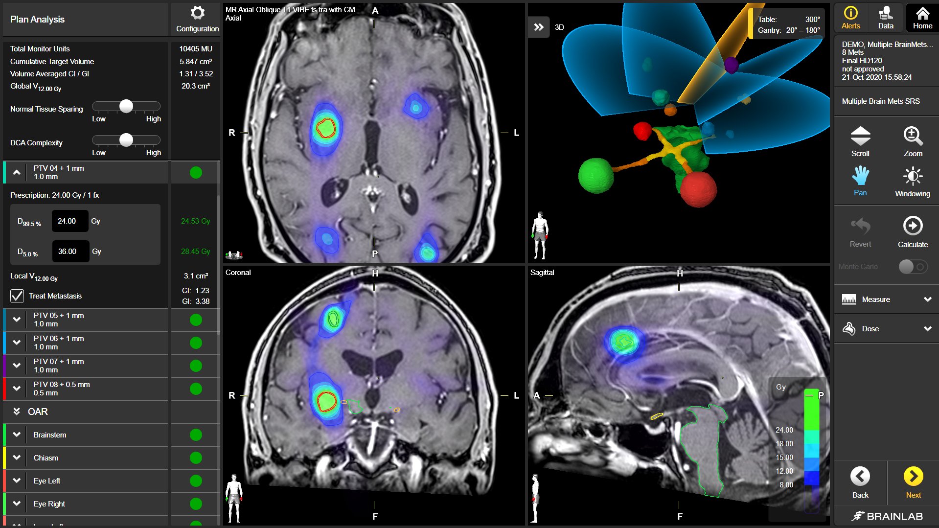 rt_sc_multiple-brain-mets-srs_2_oct2020.png