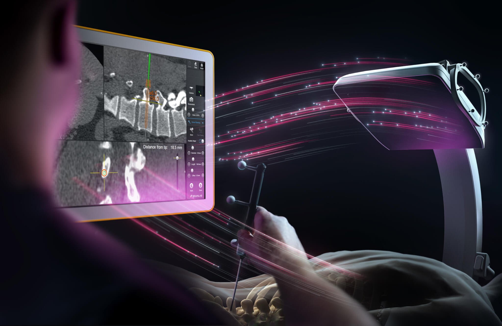 Header Background Image: Spinal Navigation Software