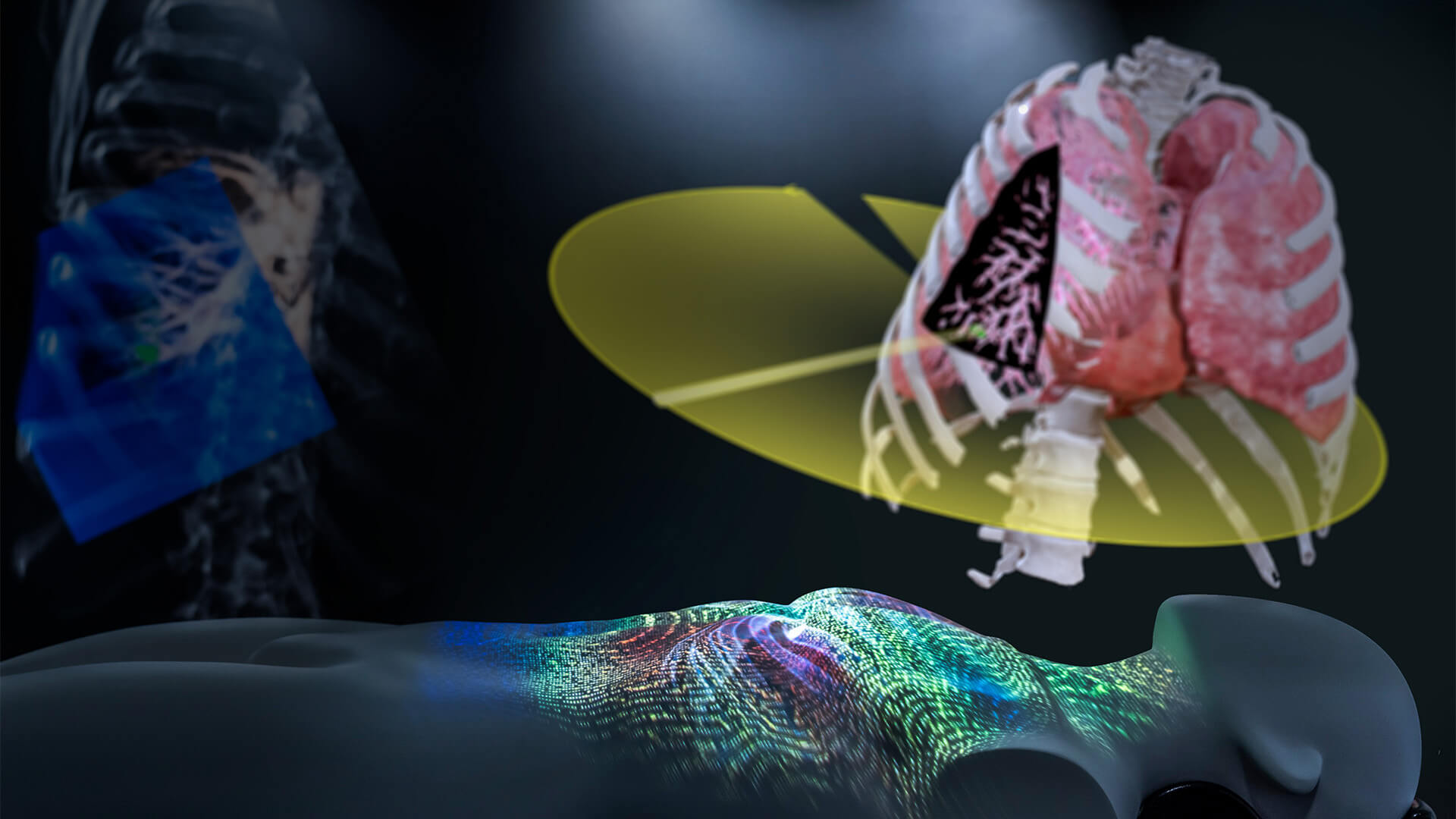 Radiosurgery Solutions: Pioneer in Radiotherapy and SRS