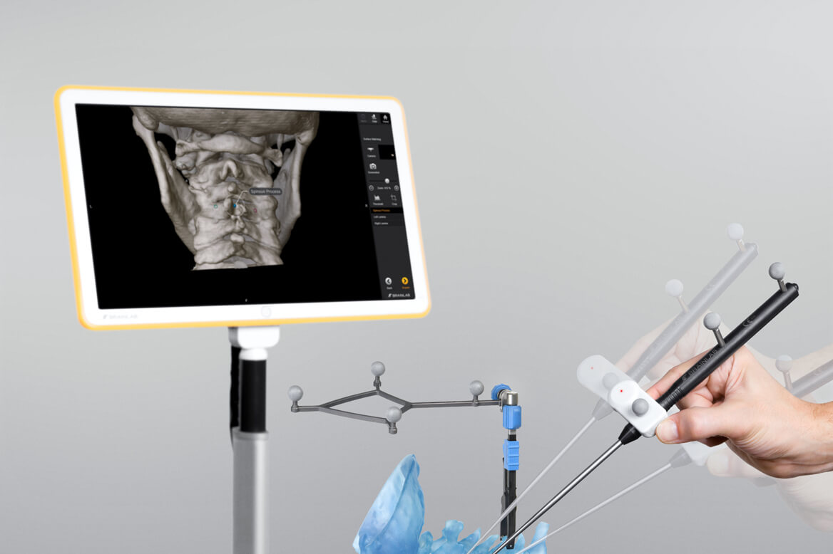Photo demonstrating Spine & Trauma Navigation seamlessly integrating into any existing O.R.