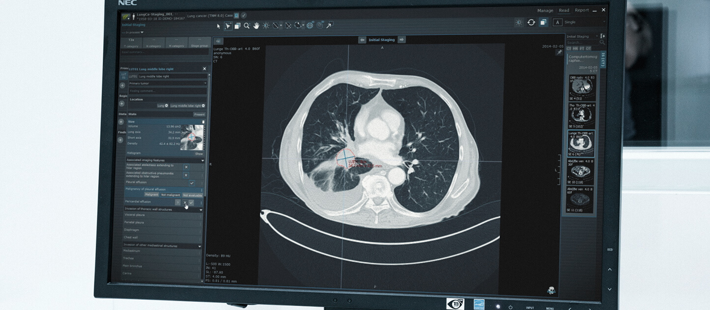 Visualization: In 2021, Brainlab acquires Mint Medical, a company specializing in medical reading and reporting software
