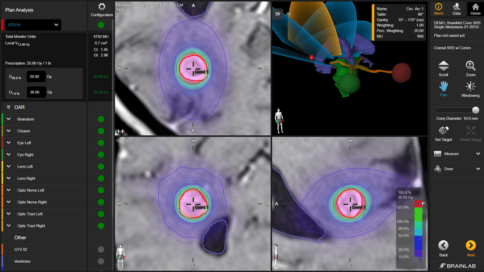 Screenshot of Elements Cranial SRS: optimized arc placement