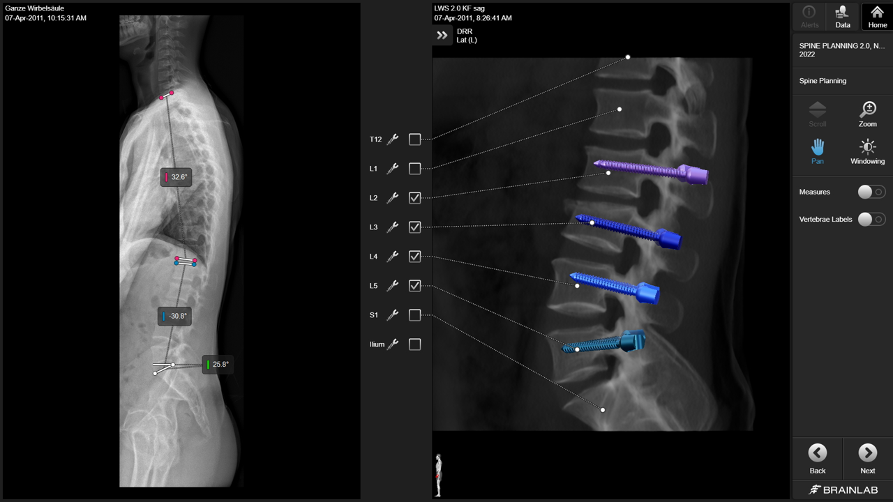spine-planning-2.0.png