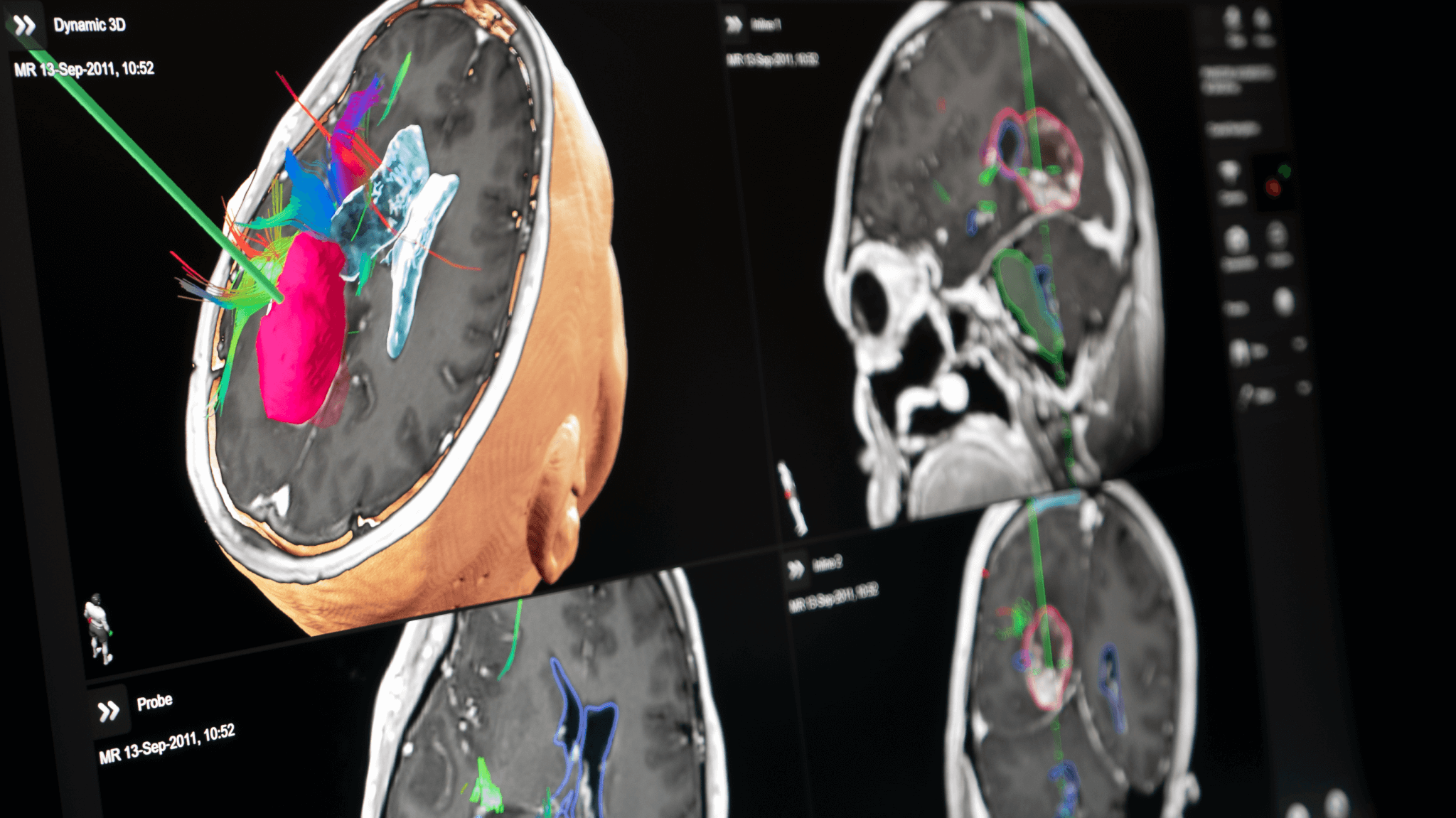 Screenshot: Detailed visualizations in Cranial Navigation