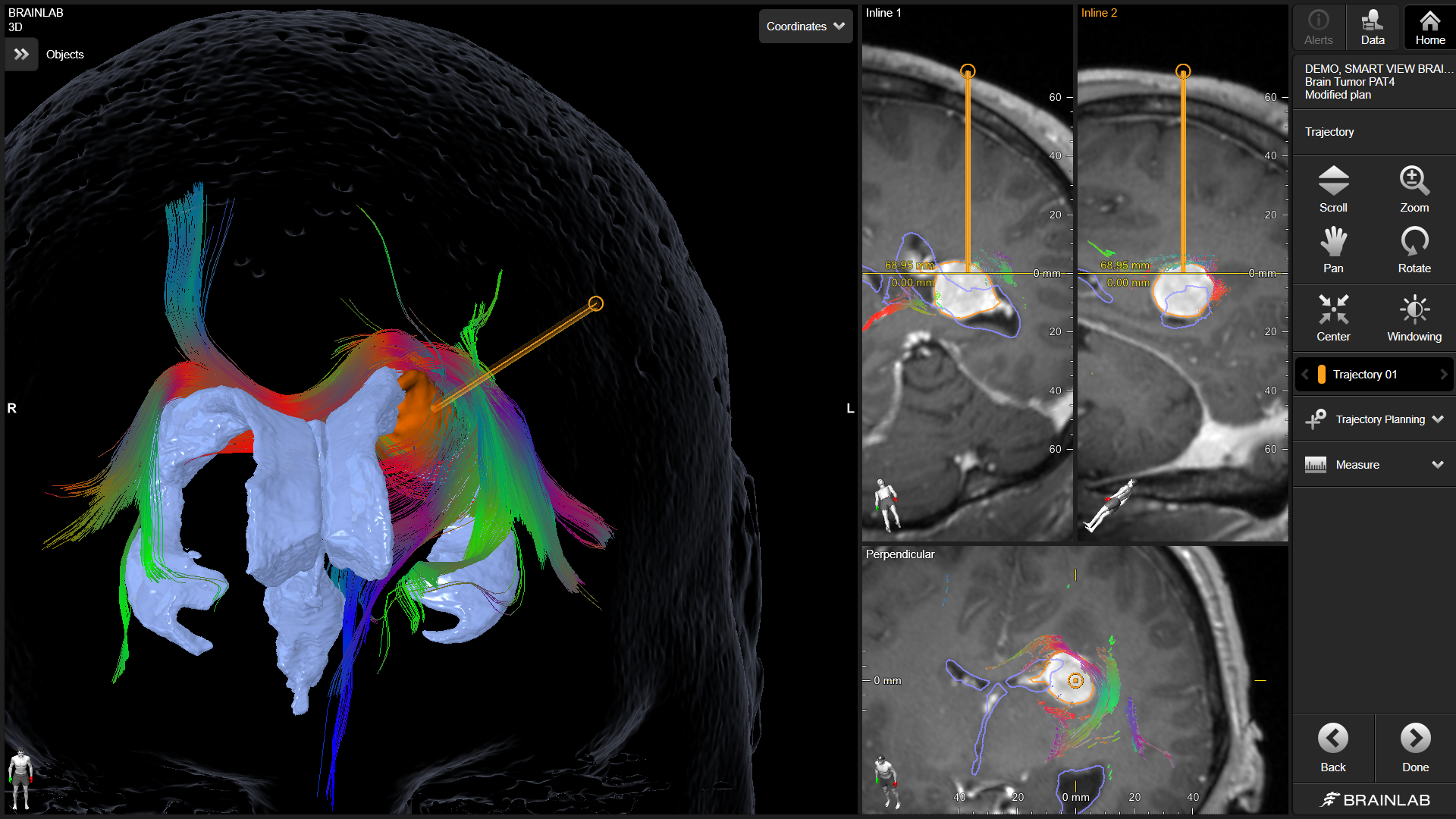 Elements Trajectory Planning Cranial 