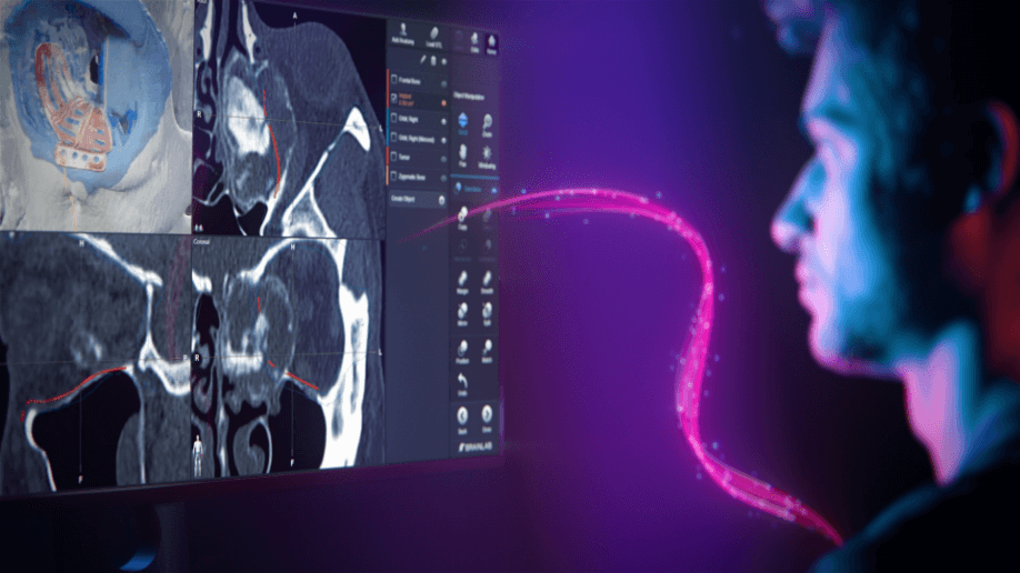 Header Image: Brainlab Craniomaxillofacial Planning software