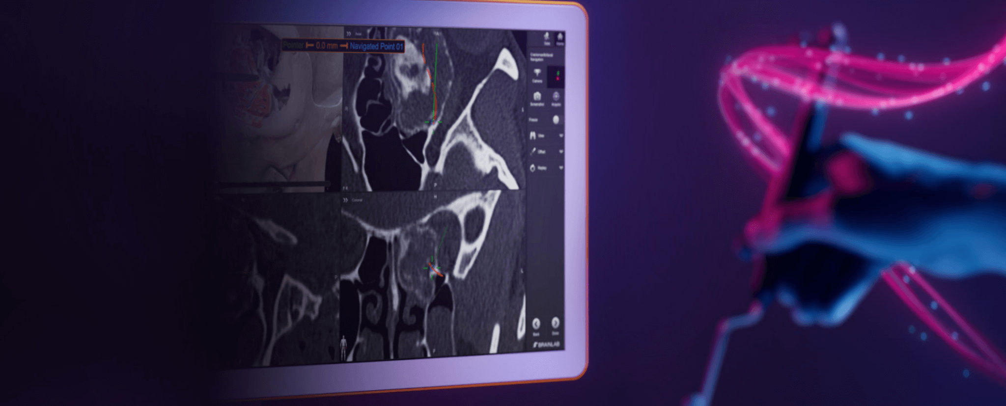 Header Image: Brainlab Craniomaxillofacial (CMF) Navigation