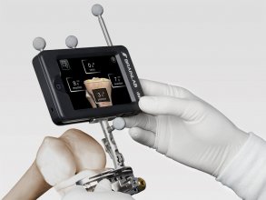 Технология Dash Smart Instrument Technology для прямого выравнивания во время операции по замене колена