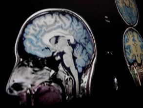 在颅脑放射外科计划期间，软件适应各种解剖结构和模态