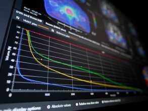 Radiotherapy software that converts DICOM RT to VMAT plans for IMRT