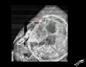 Röntgenverifizierung während der Behandlung und Positionierung