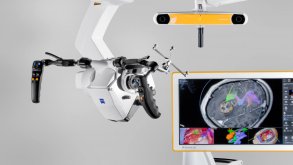 El software de navegación del microscopio quirúrgico es un componente importante de la cirugía craneal