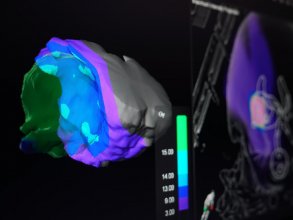 Es posible visualizar conjuntos de imágenes de varias formas, incluidas vistas únicas en 3D para visualizar la distribución de dosis.