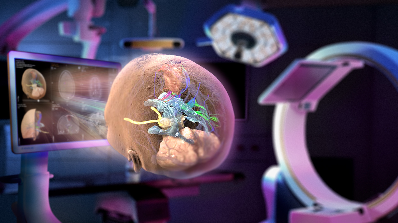 Das Bild eines menschlichen Schädels wird aus einem chirurgischen Navigationssystem in den Raum projiziert. Ein Gerät für die intraoperative Bildgebung steht im Hintergrund.