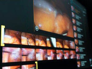 Recordings taken during surgery can be easily edited with the Brainlab Video Editor so only relevant data is stored