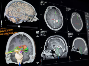 Smart Anatomy View_Cranial