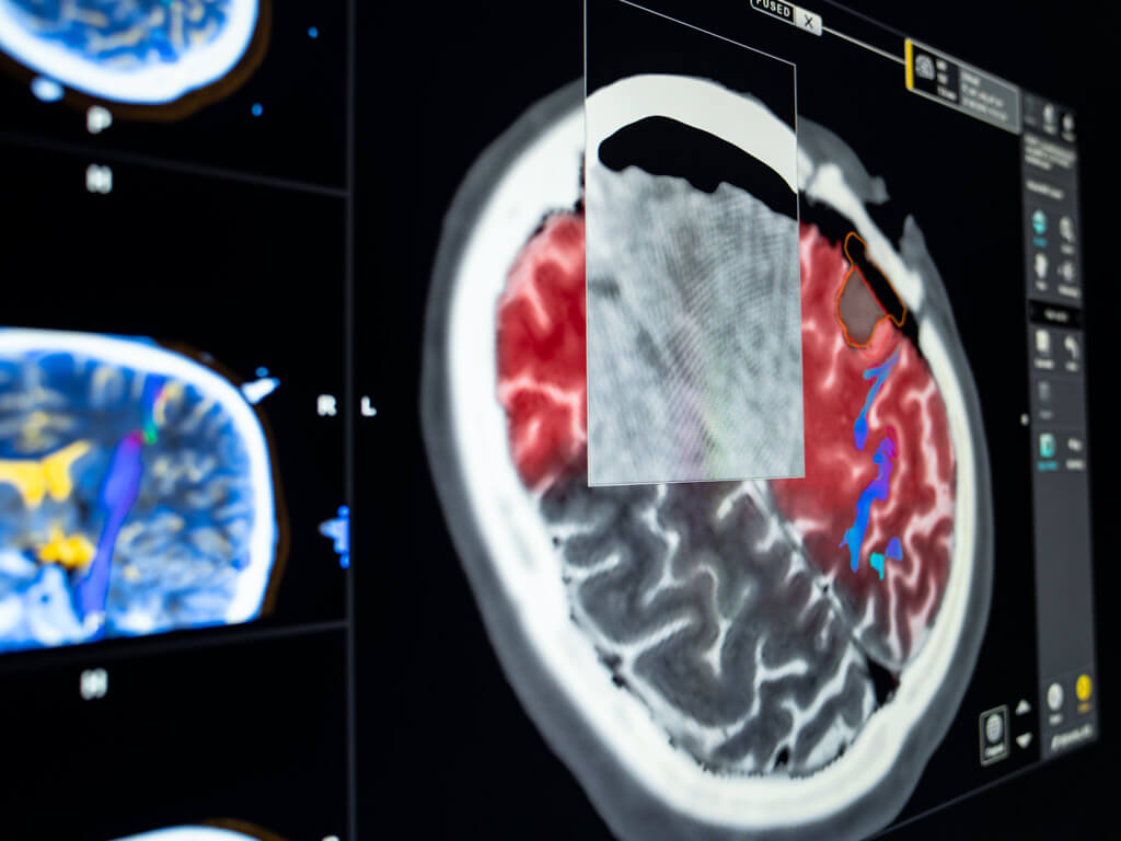 Captura de tela do Elements Cranial Product Virtual iMRI
