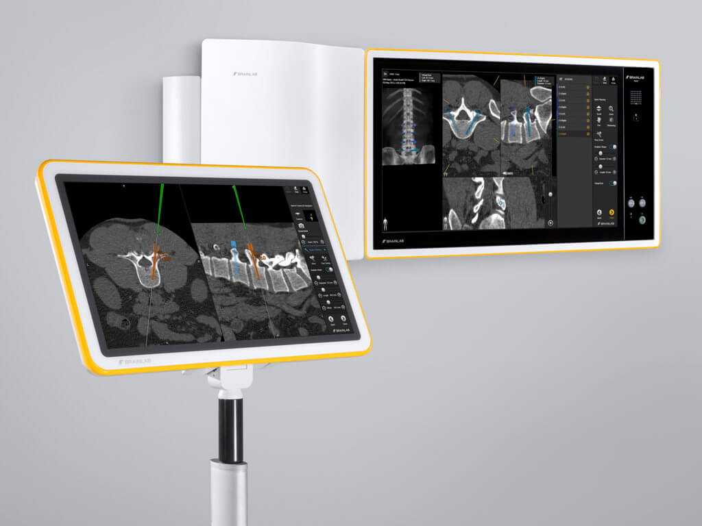 Os sistemas Buzz Digital O.R. e Cirurgias Guiadas por Imagens Kick da Brainlab trabalham juntos durante procedimentos cirúrgicos