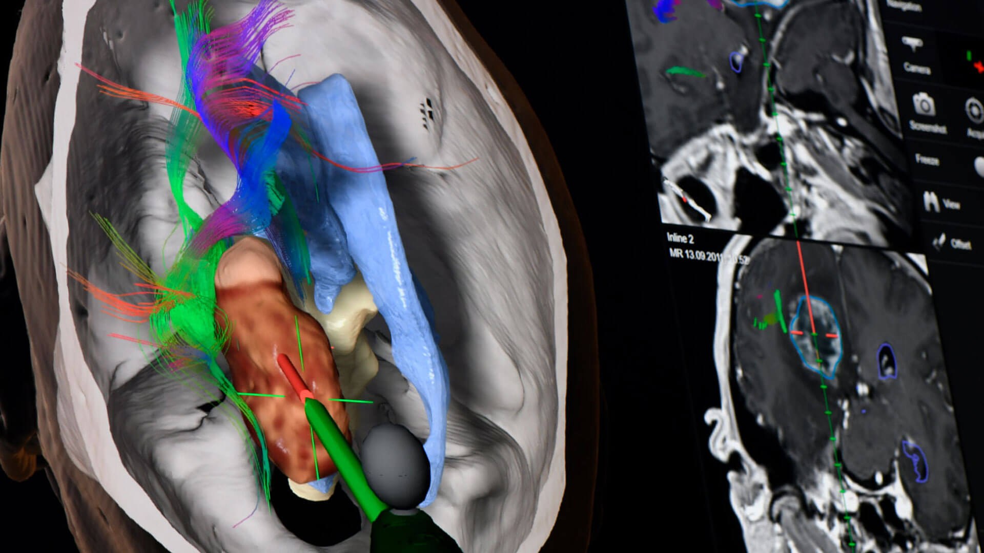 Detailed visualization of relevant anatomical information in one dedicated view