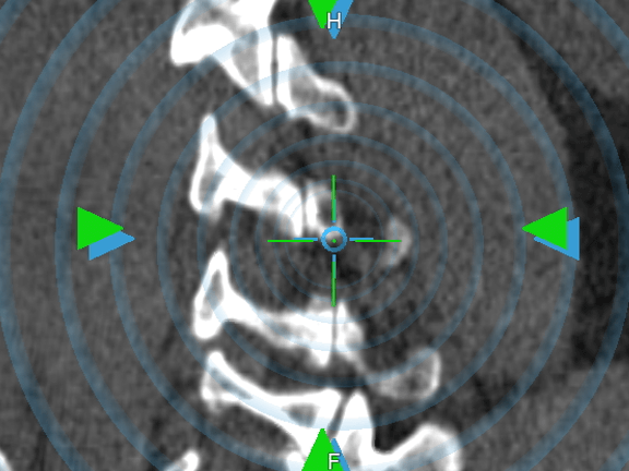 Trajectory planning for spine surgery