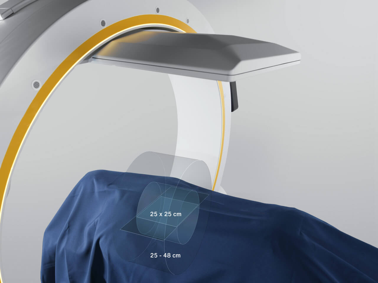 Brainlab Loop-X conebeam-ct overview field of view