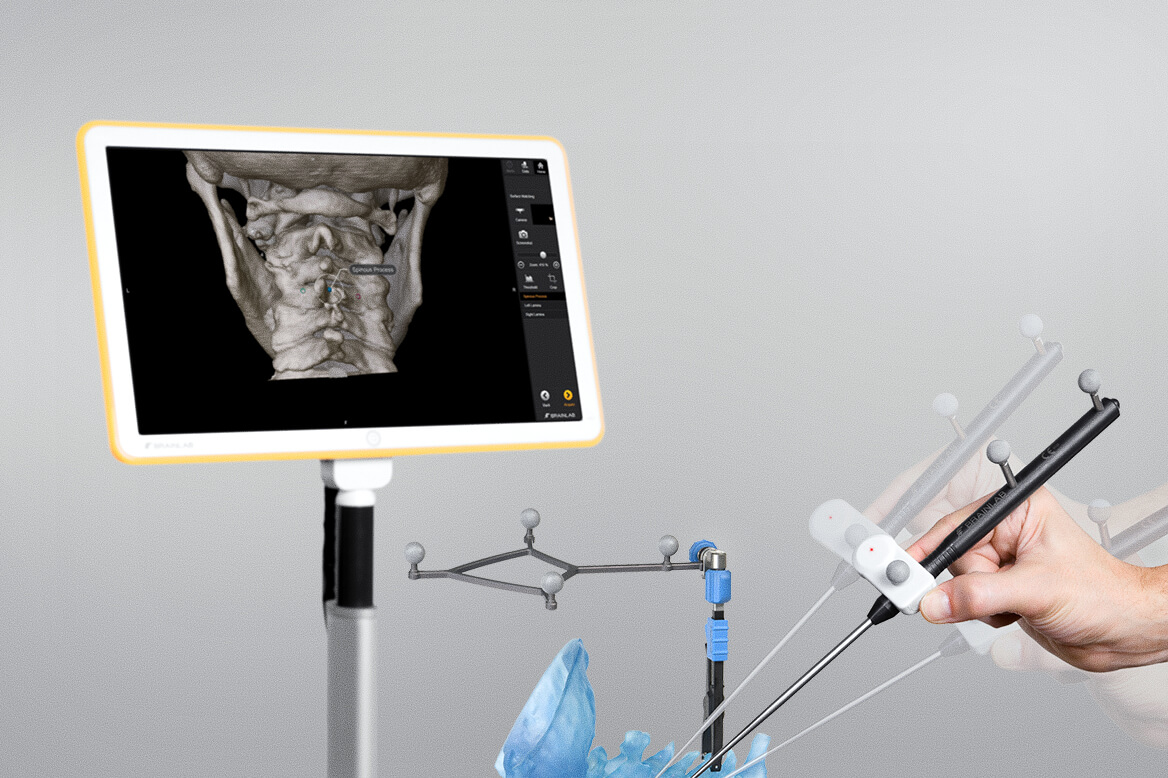 画像誘導手術のために、骨表面のポイント位置情報をマニュアルで取得するレジストレーション手法