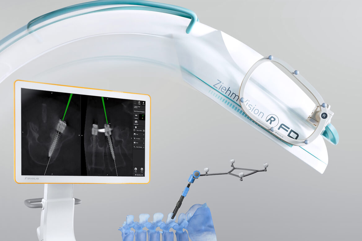 脊柱和创伤导航使用术中影像自动配准技术，例如和 Ziehm Vision RFD 3D 的三维 C 型臂实现术中自动注册