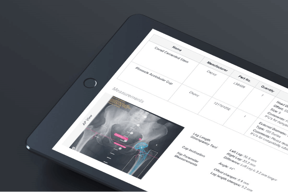 Independentemente da localização ou do dispositivo, o TraumaCad está disponível para oferecer assistência aos cirurgiões e simplificar o planejamento de procedimentos ortopédicos